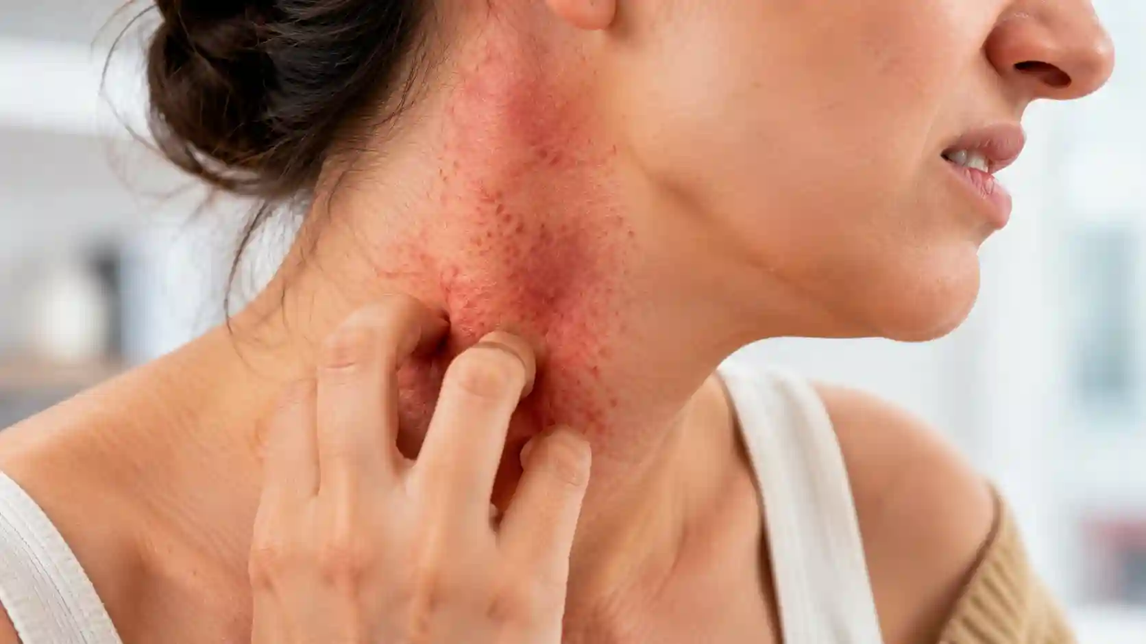 Body Itching Warning Signs: शरीर के इन 3 हिस्सों में लगातार खुजली हो सकती है लिवर, किडनी या डायबिटीज का संकेत